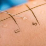 Interpreting Your Allergy Testing Results