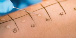 Interpreting Your Allergy Testing Results