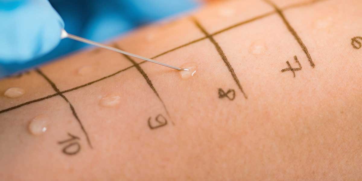 Interpreting Your Allergy Testing Results